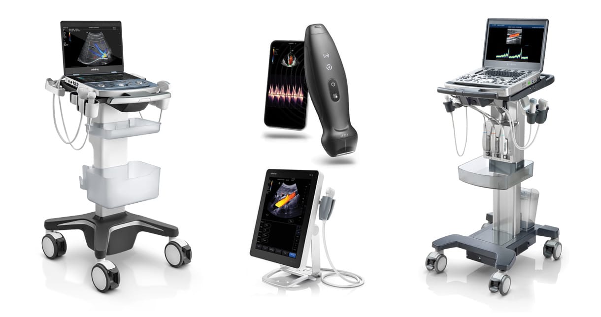 Ultrasound system used for abdominal scanning of the liver, gallbladder and pancreas